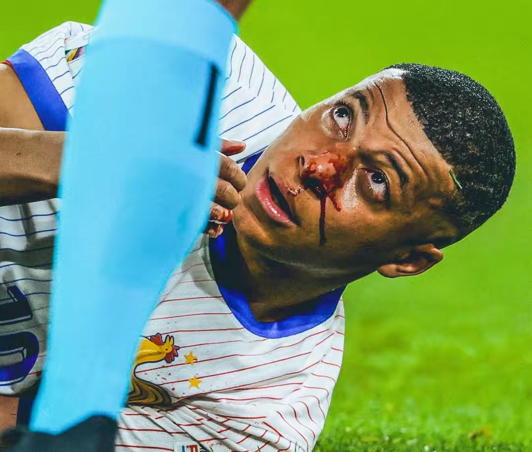 法国后卫表现出色，助球队获得胜利的简单介绍